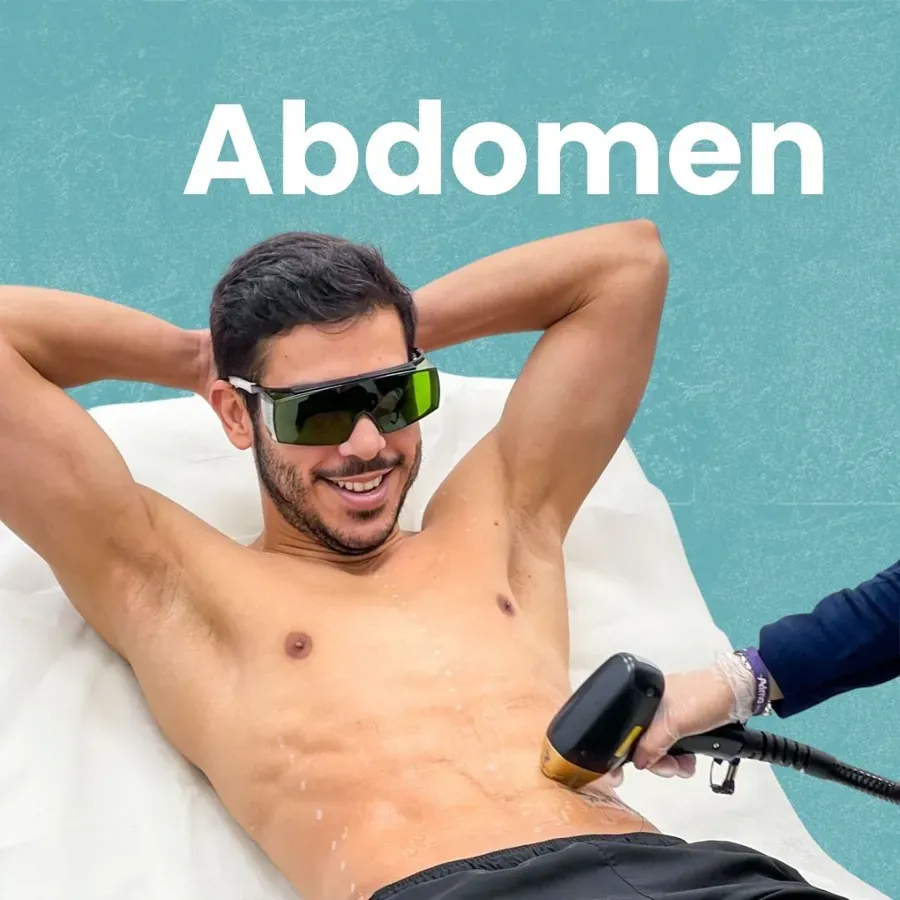 Depilación láser de abdomen en HAPPYláser