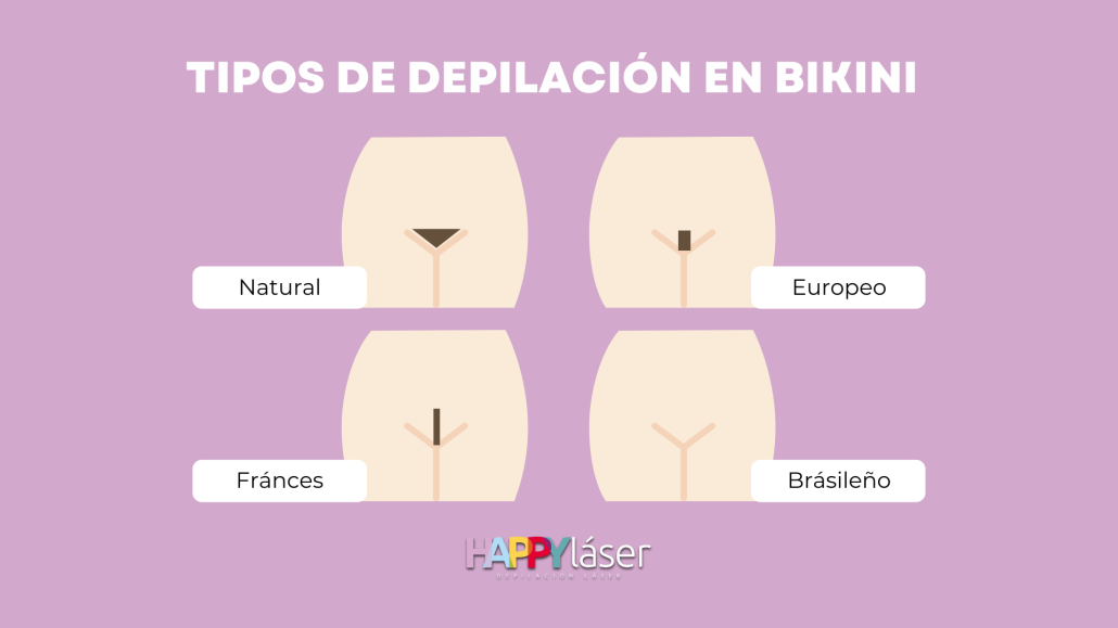 Tipos de depilación láser bikini