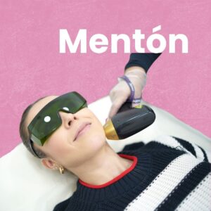 Depilación Láser Mentón en HAPPYláser