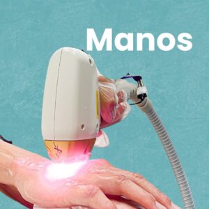 Depilación láser manos en HAPPYláser