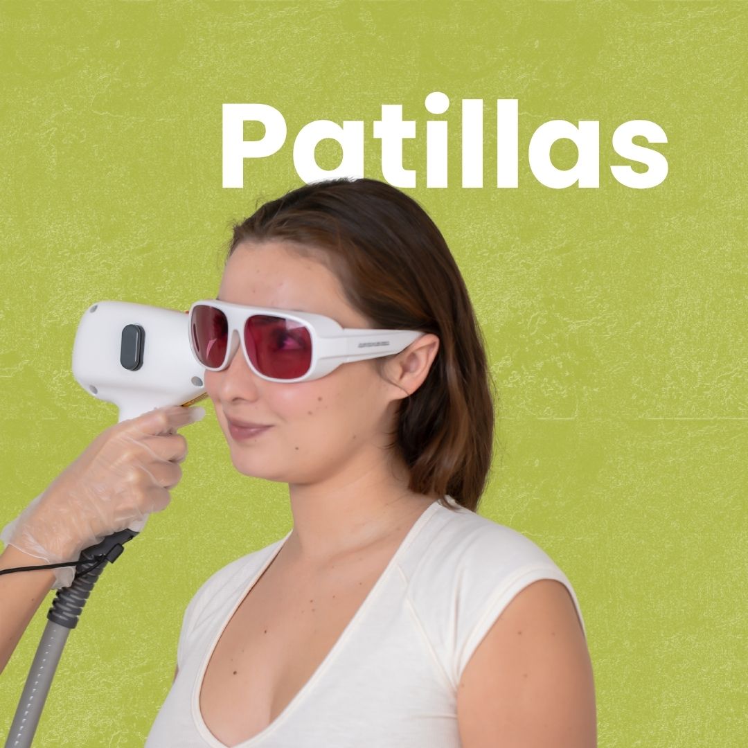 Depilación láser Patillas en HAPPYláser